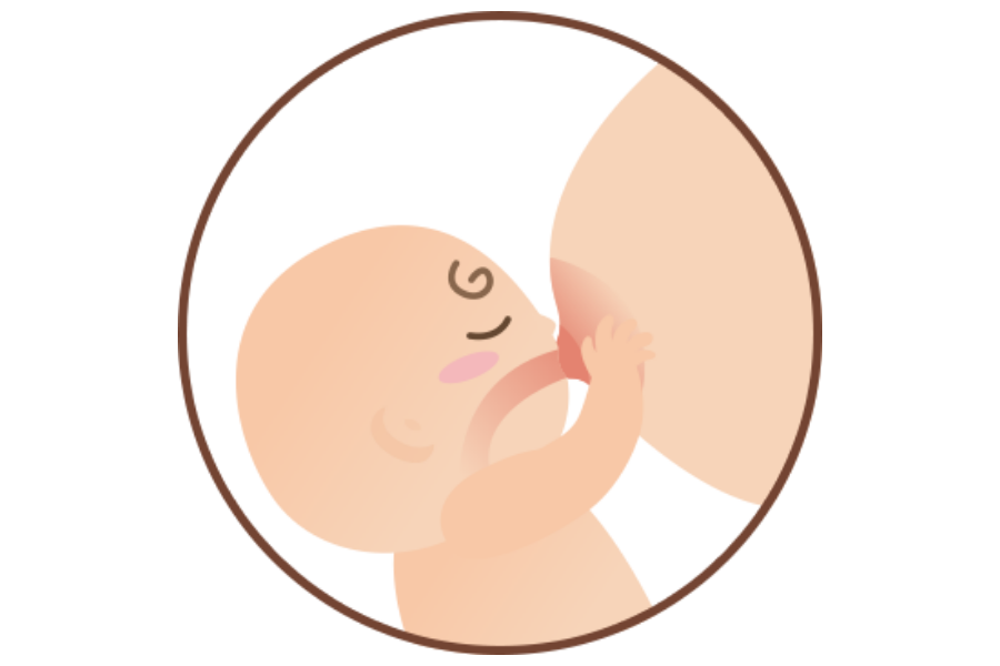 多讓寶寶吸吮，避免塞奶與乳腺阻塞
